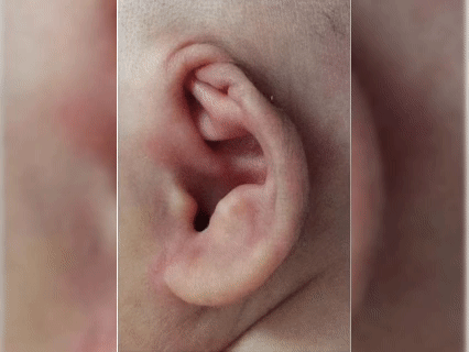 17.gif