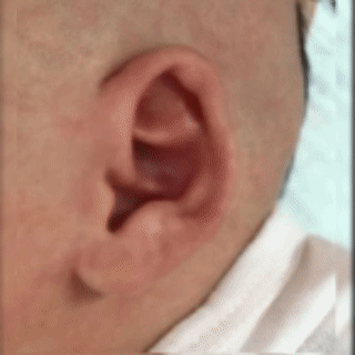 17.gif