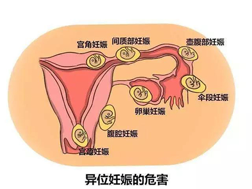 微信图片_20181130161200.jpg