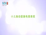 小儿抽动症脑电图表现