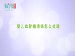 婴儿血管瘤溃疡怎么处理