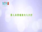 婴儿血管瘤激光几次好