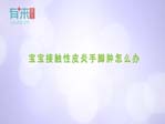 宝宝接触性皮炎手脚肿怎么办