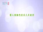 婴儿接触性皮炎几天能好