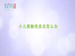 小儿接触性皮炎怎么办