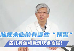 脑梗来临前“预警”：长着“狗尾巴”的颈动脉斑块#健康科普