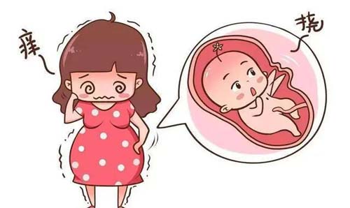 孕妇icp症状（孕妇icp症状图片） 孕妇icp症状（孕妇icp症状图片）〔孕妇icp的诊断标准〕 新闻资讯